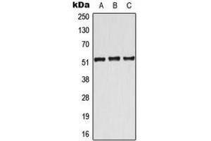 Western blot analysis of ATF7 expression in Jurkat (A), Raw264. (AFT7 antibody  (Center))