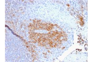Immunohistochemistry (IHC) image for anti-CD27 Molecule (CD27) antibody (ABIN6941124)