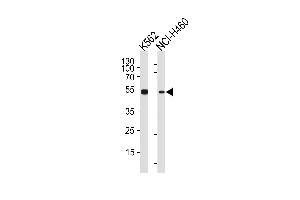 CHEK2 Antibody (N-term) (ABIN1881196 and ABIN2840120) western blot analysis in K562,NCI- cell line lysates (35 μg/lane).