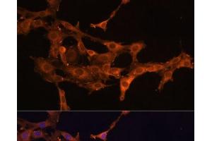 Immunofluorescence analysis of C6 cells using DCN Polyclonal Antibody at dilution of 1:100 (40x lens). (Decorin antibody)