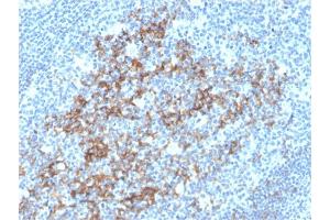 Formalin-fixed, paraffin-embedded human Tonsil stained with CD23-Monospecific Mouse Monoclonal Antibody (FCER2/3592). (FCER2 antibody  (AA 48-321))