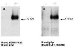 Combined immunoprecipitation and western blot using EGFR antibody.