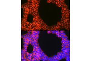 Immunofluorescence (IF) image for anti-CD70 Molecule (CD70) (AA 39-193) antibody (ABIN3022743)
