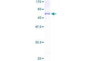 GCAT Protein (AA 1-419) (GST tag)