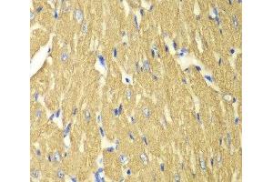 Immunohistochemistry of paraffin-embedded Mouse heart using TPM3 Polyclonal Antibody at dilution of 1:100 (40x lens). (TPM3 antibody)