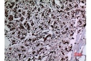 Immunohistochemical analysis of paraffin-embedded human-breast, antibody was diluted at 1:100. (HSP90 antibody  (acLys284, acLys292))
