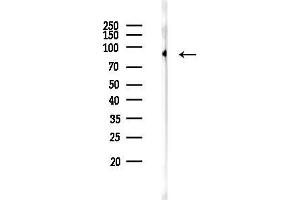 Western blot analysis of lysates from HUVEC cells, using Phospho-S (Tyr694) Antibody at 1/1000 dilution.