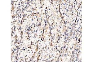 IHC analysis of Integrin Linked ILK using anti-Integrin Linked ILK antibody (ABIN7599411). (ILK antibody  (AA 1-452))