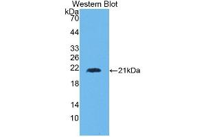 Detection of Recombinant HMMR, Human using Polyclonal Antibody to Hyaluronan Mediated Motility Receptor (HMMR) (HMMR antibody  (AA 577-724))