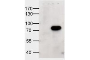 Image no. 1 for anti-ATP-Binding Cassette, Sub-Family D (Ald), Member 1 (ABCD1) (Internal Region) antibody (ABIN452684)