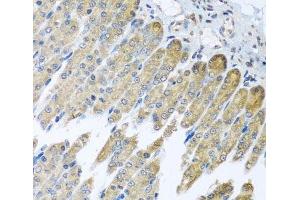 Immunohistochemistry of paraffin-embedded Mouse stomach using NDUFB10 Polyclonal Antibody at dilution of 1:100 (40x lens). (NDUFB10 antibody)