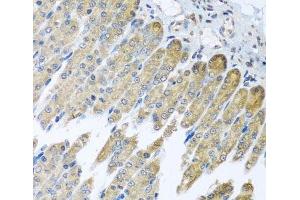 Immunohistochemistry of paraffin-embedded Mouse stomach using NDUFB10 Polyclonal Antibody at dilution of 1:100 (40x lens).