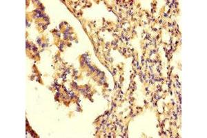 Immunohistochemistry of paraffin-embedded human lung tissue using ABIN7161472 at dilution of 1:100 (Neurotrypsin antibody  (AA 631-874))
