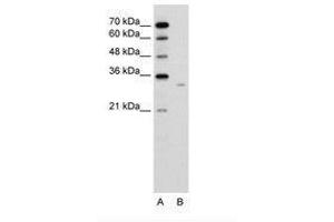 Image no. 2 for anti-Dicarbonyl/L-Xylulose Reductase (DCXR) (AA 151-200) antibody (ABIN6736636) (DCXR antibody  (AA 151-200))