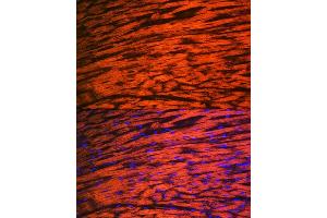 Immunofluorescence analysis of rat heart using MYL2 Rabbit mAb (ABIN7268761) at dilution of 1:100 (40x lens). (MYL2 antibody)