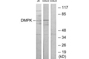 Western blot analysis of extracts from Jurkat cells and COLO205 cells, using DMPK antibody. (DMPK antibody  (N-Term))