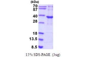 SDS-PAGE (SDS) image for Pyrroline-5-Carboxylate Reductase Family, Member 2 (PYCR2) (AA 1-320) protein (His tag) (ABIN5854206) (PYCR2 Protein (AA 1-320) (His tag))
