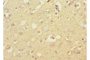 Immunohistochemistry of paraffin-embedded human brain tissue using ABIN7170731 at dilution of 1:100 (STRADA antibody  (AA 25-210))