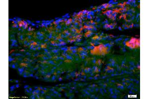 Formalin-fixed and paraffin embedded rat testis labeled with Anti- SCP3 Polyclonal Antibody, Unconjugated (ABIN747383) at 1:200 followed by secondary antibody was Goat Anti-Rabbit IgG, Cy3 conjugated used at 1:200 dilution for 40 minutes at 37°C. (SYCP3 antibody  (AA 145-250))