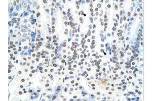 Image no. 1 for anti-RING Finger Protein 6 (RNF6) (N-Term) antibody (ABIN202860) (RNF6 antibody  (N-Term))