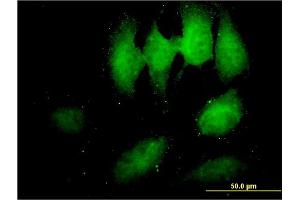 Immunofluorescence of monoclonal antibody to TOMM34 on HeLa cell. (TOMM34 antibody  (AA 1-309))