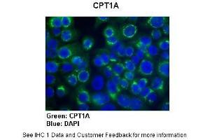 Sample Type :  Human Capan1 cells (Pancreatic cancer cell line)  Primary Antibody Dilution :  1:300  Secondary Antibody :   Anti-rabbit-AlexaFluor-488  Secondary Antibody Dilution :  1:200  Color/Signal Descriptions :  CPT1A: Green DAPI: Blue  Gene Name :  CPT1A  Submitted by :  Dr. (CPT1A antibody  (Middle Region))