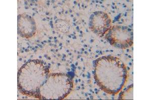 Used in DAB staining on fromalin fixed paraffin- embedded Kidney tissue (TRPV6 antibody  (AA 578-725))