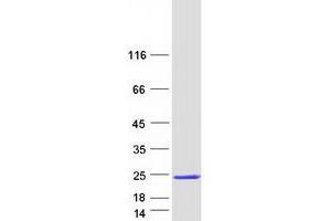 Validation with Western Blot