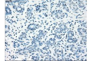 Immunohistochemical staining of paraffin-embedded breast tissue using anti-LTA4H mouse monoclonal antibody. (LTA4H antibody)