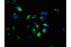 Immunofluorescence staining of A549 cells with ABIN7146512 at 1:533, counter-stained with DAPI. (Calpain S1 antibody  (AA 1-268))