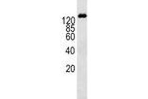 P-Glycoprotein antibody western blot analysis in K562 lysate (P-Glycoprotein antibody  (AA 647-677))