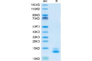 TGFB3 Protein (AA 301-412)