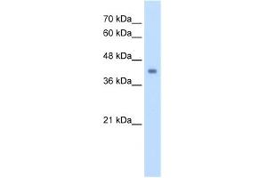 WB Suggested Antibody Titration:  2. (GCDH antibody  (C-Term))