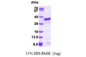 SDS-PAGE (SDS) image for Ubiquitin-Conjugating Enzyme E2S (UBE2S) (AA 1-222) protein (His tag) (ABIN666888)