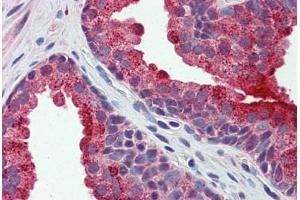 Human Prostate: Formalin-Fixed, Paraffin-Embedded (FFPE) (APEH antibody  (AA 144-193))