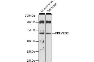 Western blot analysis of extracts of various cell lines, using KREMEN2 antibody (ABIN7268149) at 1:1000 dilution. (KREMEN2 antibody  (AA 200-360))