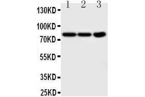 Anti-TrkA antibody,  Western blotting Lane 1: COLO320 Cell Lysate Lane 2:  Cell Lysate Lane 3: U87 Cell Lysate (TRKA antibody  (N-Term))