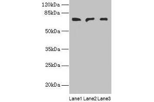Western blot All lanes: PLCZ1 antibody at 3 μg/mL Lane 1: Mouse liver tissue Lane 2: Mouse kidney tissue Lane 3: Human placenta tissue Secondary Goat polyclonal to rabbit IgG at 1/10000 dilution Predicted band size: 71, 48, 58 kDa Observed band size: 71 kDa (PLCz1 antibody  (AA 1-415))