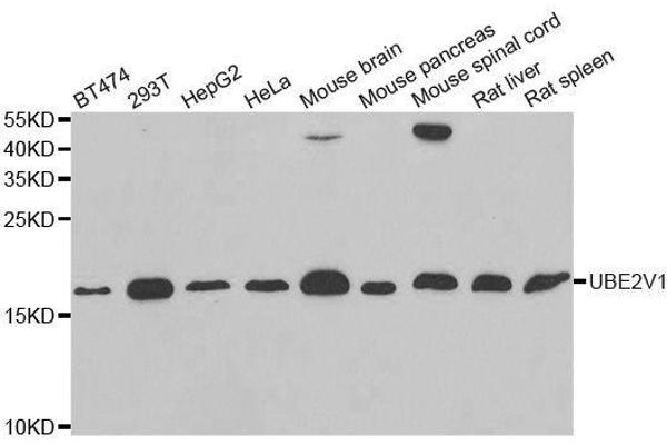 UBE2V1 antibody  (AA 1-147)