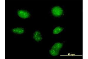 Immunofluorescence of purified MaxPab antibody to ZCCHC13 on HeLa cell. (ZCCHC13 antibody  (AA 1-166))