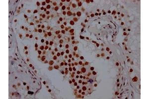 Immunohistochemistry (IHC) image for anti-Poly A Binding Protein Nuclear 1 (PABPN1) antibody (ABIN7127661)
