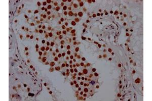 IHC image of ABIN7127661 diluted at 1:100 and staining in paraffin-embedded human testis tissue performed on a Leica BondTM system. (Recombinant PABPN1 antibody)