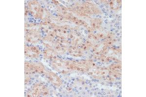 Immunohistochemistry of paraffin-embedded mouse kidney using CLDN17 antibody (ABIN7266407) at dilution of 1:100 (40x lens). (Claudin 17 antibody  (C-Term))