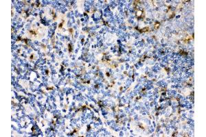 Anti- Cystatin A Picoband antibody, IHC(P) IHC(P): Human Tonsil Tissue (CSTA antibody  (AA 8-98))