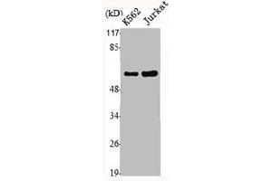 Western Blot analysis of Jurkat K562 cells using MMP-1 Polyclonal Antibody (MMP1 antibody  (C-Term))