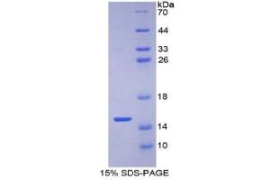 SDS-PAGE of Protein Standard from the Kit (Highly purified E. (GLUT1 ELISA Kit)