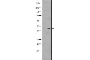 Western blot analysis of DMRTB1 expression in Jurkat cell lysate. (DMRTB1 antibody  (C-Term))