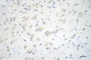 Immunohistochemistry was performed on paraffin-embedded mouse brain using ADAM17 antibody (ABIN7797502), 1:200).