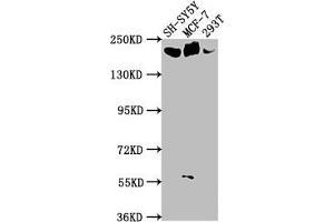 Western Blot Positive WB detected in: SH-SY5Y whole cell lysate, MCF-7 whole cell lysate, 293T whole cell lysate All lanes: LAMA4 antibody at 1:1000 Secondary Goat polyclonal to rabbit IgG at 1/50000 dilution Predicted band size: 203, 202, 13 kDa Observed band size: 203 kDa (LAMa4 antibody  (AA 1593-1823))