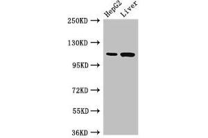 Western Blot Positive WB detected in: HepG2 whole cell lysate, Rat liver tissue All lanes: Tmprss15 antibody at 3 μg/mL Secondary Goat polyclonal to rabbit IgG at 1/50000 dilution Predicted band size: 119 kDa Observed band size: 119 kDa